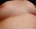 bauch2.jpg