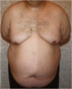 Dateiname=bauch1.JPG
Dateigröße=28KB
Abmessungen: 441x541
hinzugefügt am: 24. Februar 2014 bauch1.JPG