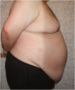 Dateiname=bauch2.JPG
Dateigröße=31KB
Abmessungen: 441x523
hinzugefügt am: 24. Februar 2014 bauch2.JPG